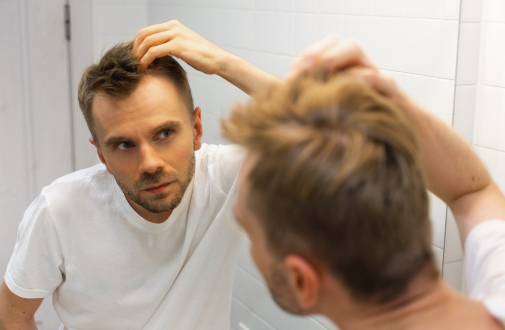 Man kijkt bezorgd naar zijn haar in de spiegel, door haaruitval